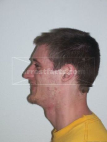 Jacob M Metz
