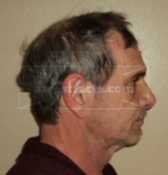 Calvin Gene Partlow