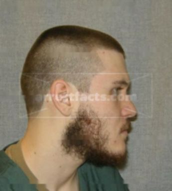 Nicholas P Graewin