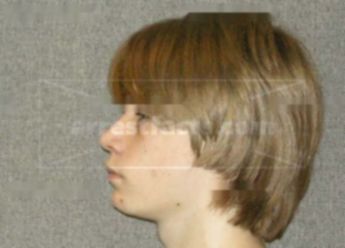 Timothy G Meyers