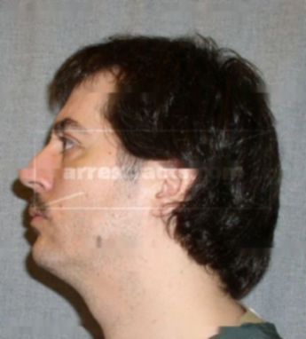 Lamar J Blindauer
