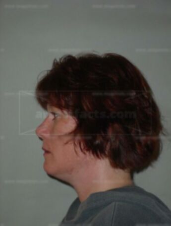 Elizabeth A Jackson