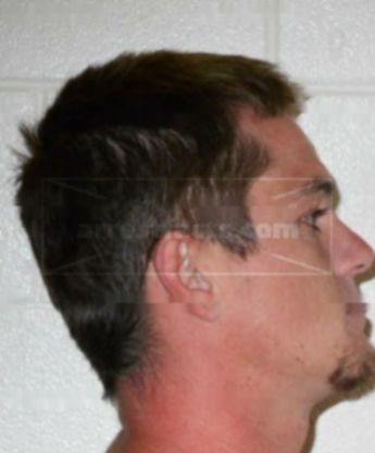 Michael James Burkhart