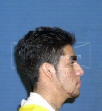 Zalatiel C Gonzalez
