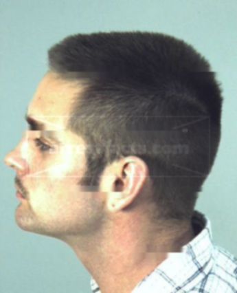 Travis L Harbison