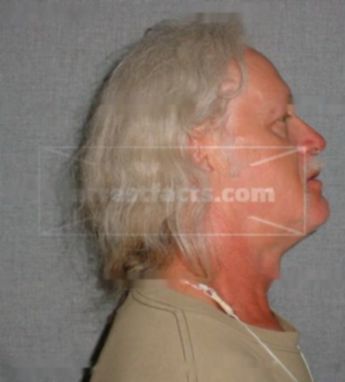Michael J Shaffer