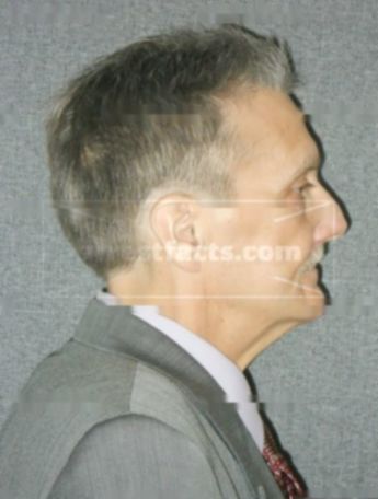 Brian E Mcnicholas