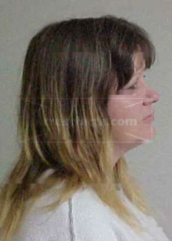 Cynthia J Buntin
