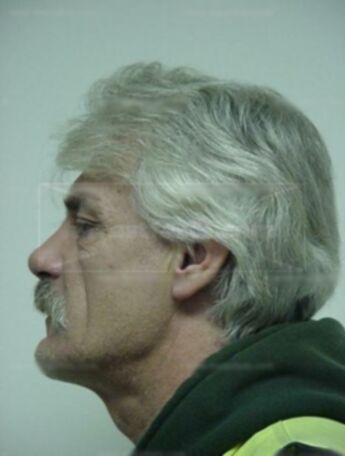 Patrick W Gibbs