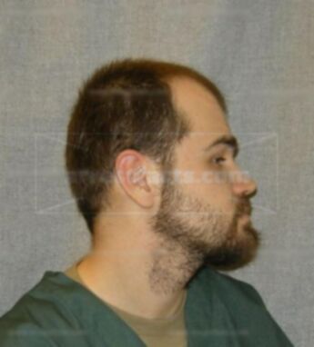 Bradley M Gross