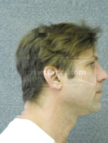 Lyle R Siebert Jr.