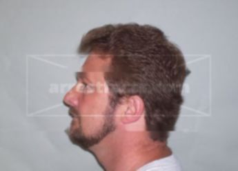 Duane A Klein