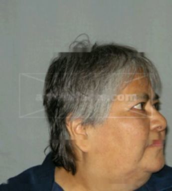 Bonnie R Kaquatosh