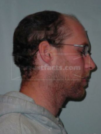 Christopher J Forst