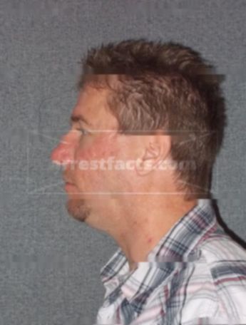 Todd Allan Phillips