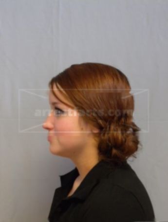 Samantha A Molkentin
