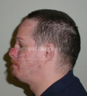 Timothy S Mullins
