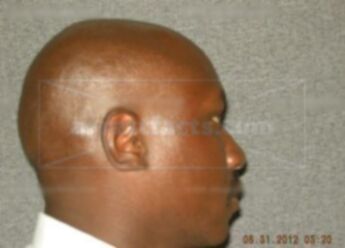 Tony Staten
