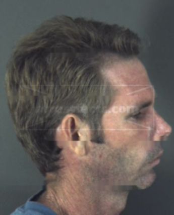 James Franklin Gause