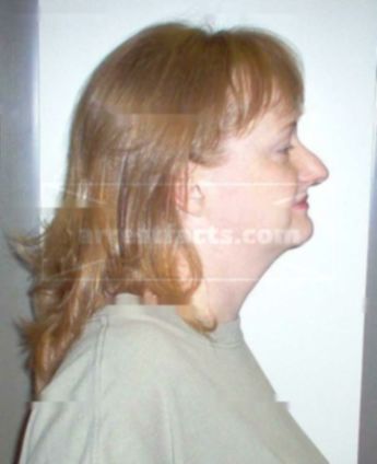 Alicia D Battershell