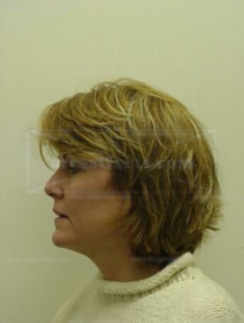 Robyn K Anderson