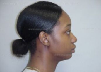 Chonitha L Douglas