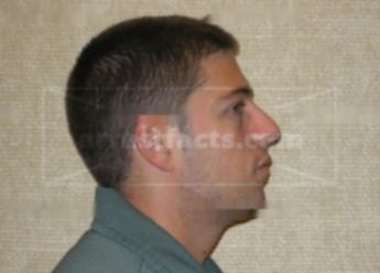 Tyler Garrett Stoltz