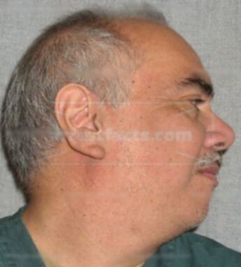 James J Landa