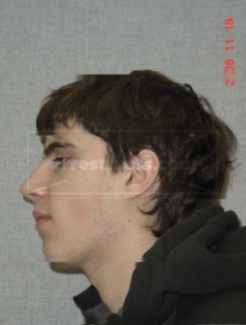 Harrison R Anderson